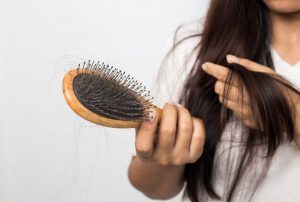 טיפול בנשירת שיער: כל מה שרציתם לדעת
